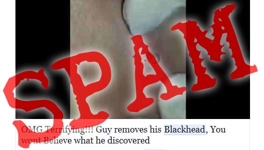 “Terrifying Guy Removes Blackhead” viral Facebook video