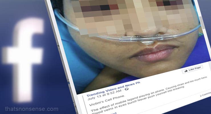 Warning claims mobile games can cause blood veins in eyes to burst – Fact Check