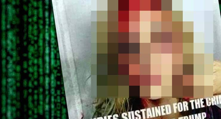 Does this photo show a bloodied female Trump supporter?