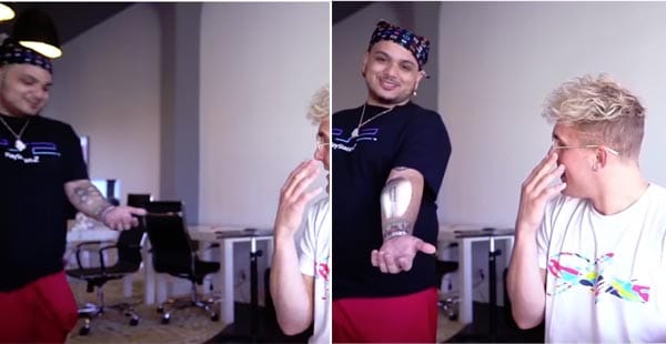 Kapper Algebra verzoek Did a vlogger have a video camera surgically put into his arm? Fact Check -  ThatsNonsense.com